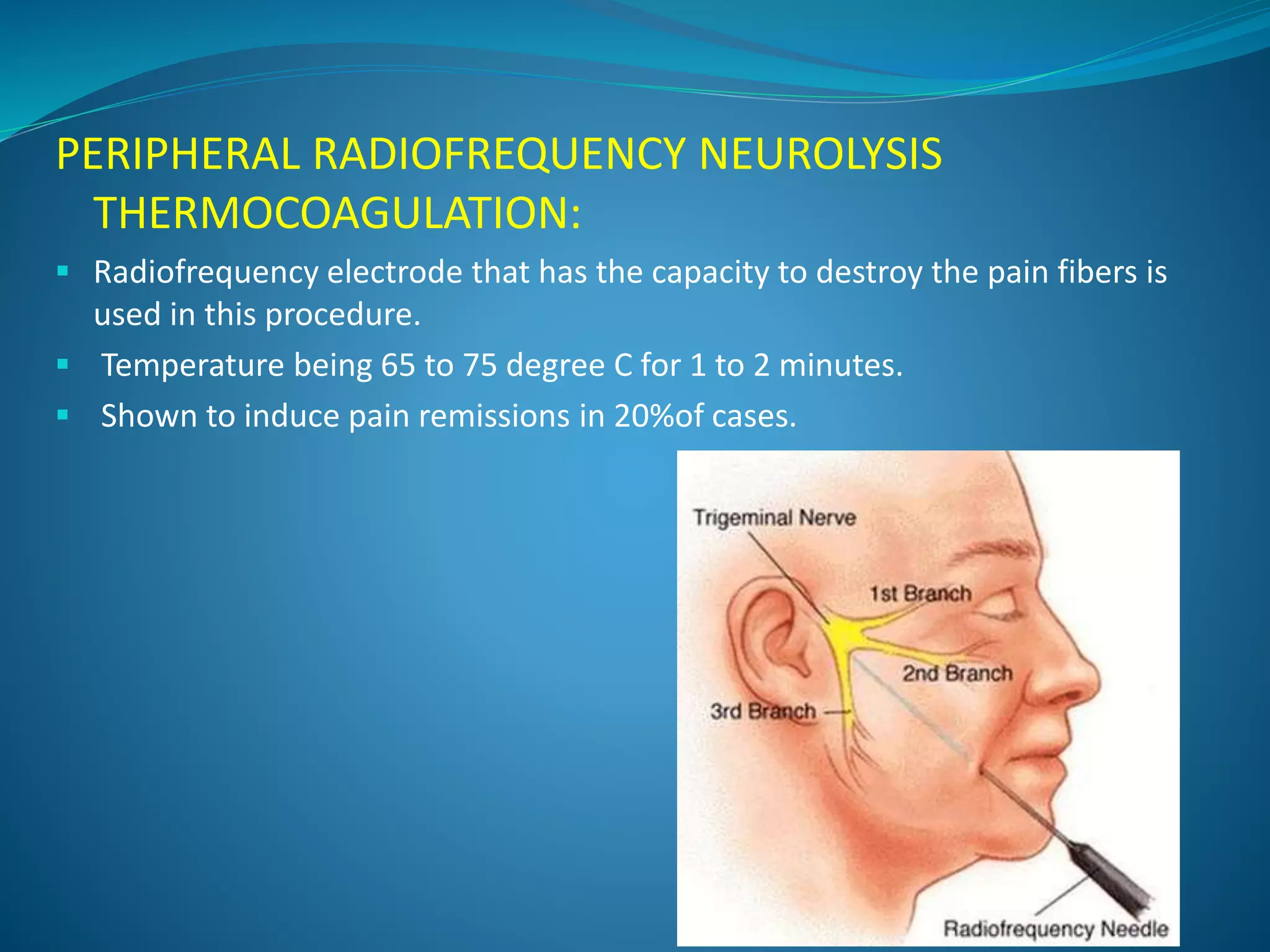 PERIPHERAL RADIOFREQUENCY NEUROLYSIS
THERMOCOAGULATION:
 Radiofrequency electrode that has the capacity to destroy the pain fibers is
used in this procedure.
 Temperature being 65 to 75 degree C for 1 to 2 minutes.
 Shown to induce pain remissions in 20%of cases.
 