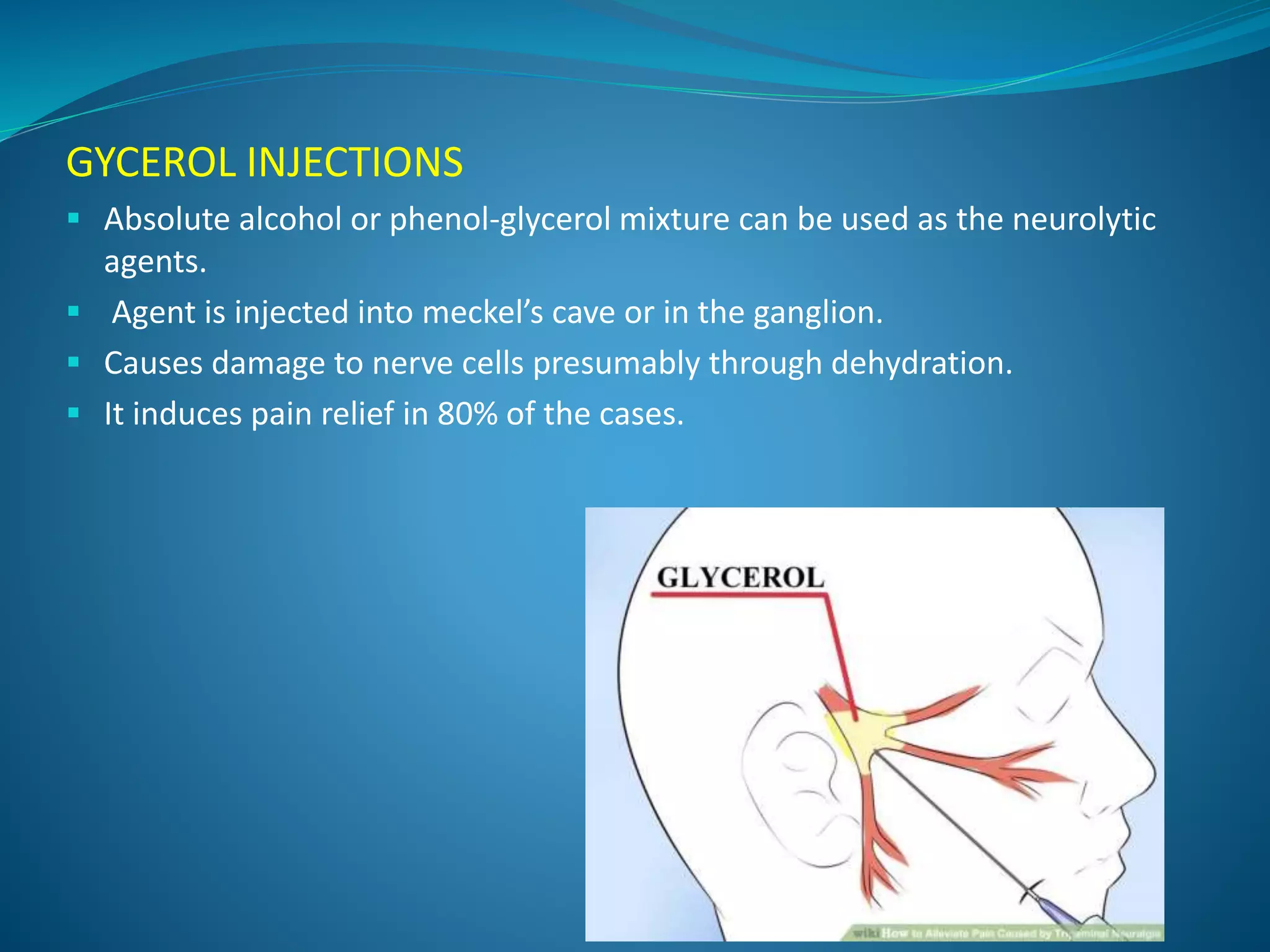 GYCEROL INJECTIONS
 Absolute alcohol or phenol-glycerol mixture can be used as the neurolytic
agents.
 Agent is injected into meckel’s cave or in the ganglion.
 Causes damage to nerve cells presumably through dehydration.
 It induces pain relief in 80% of the cases.
 