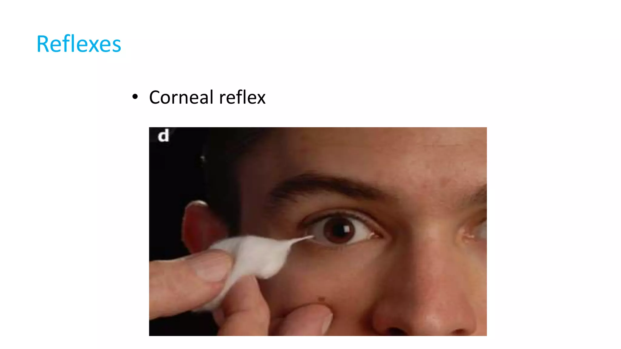 Trigeminal nerve cranial nerve | PPTX