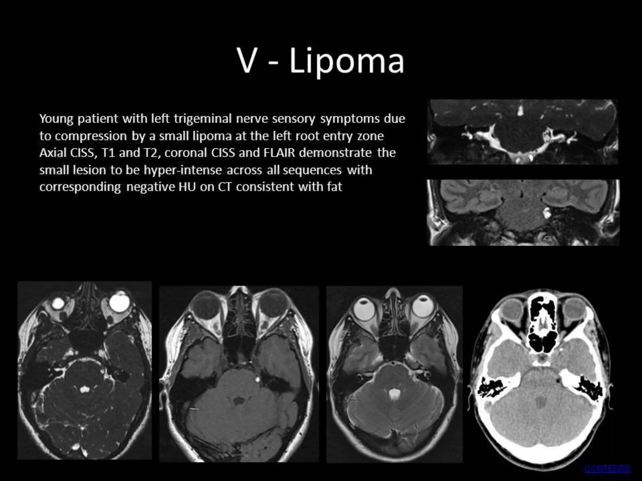 SNELL’S ANATOMY, 7TH EDITION,
RICHARD S. SNELL. 66
 