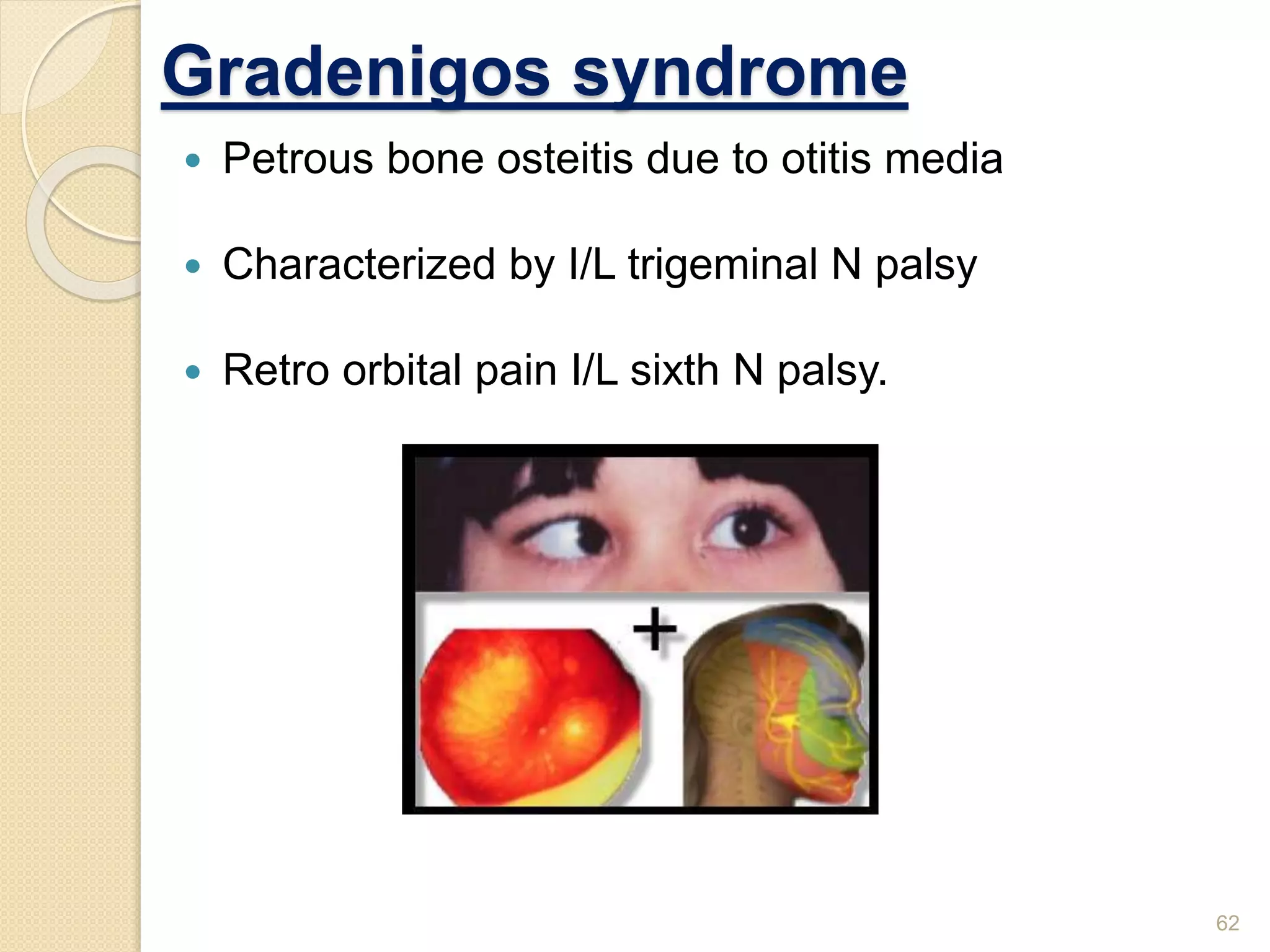 Gradenigos syndrome
 Petrous bone osteitis due to otitis media
 Characterized by I/L trigeminal N palsy
 Retro orbital pain I/L sixth N palsy.
62
 
