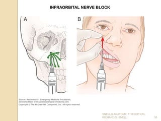 35
INFRAORBITAL NERVE BLOCK
SNELL’S ANATOMY, 7TH EDITION,
RICHARD S. SNELL.
 
