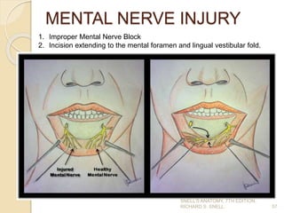 MENTAL NERVE INJURY
57
1. Improper Mental Nerve Block
2. Incision extending to the mental foramen and lingual vestibular fold.
SNELL’S ANATOMY, 7TH EDITION,
RICHARD S. SNELL.
 