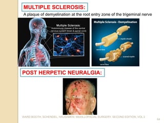 WARD BOOTH, SCHENDEL, HAUSAMEN; MAXILLOFACIAL SURGERY, SECOND EDITION, VOL 2
64
MULTIPLE SCLEROSIS:
A plaque of demyelination at the root entry zone of the trigeminal nerve
POST HERPETIC NEURALGIA:
 