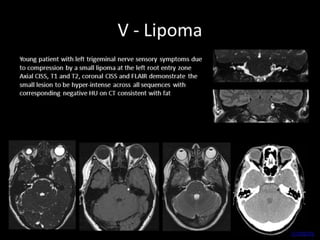 SNELL’S ANATOMY, 7TH EDITION,
RICHARD S. SNELL. 66
 
