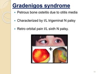 Gradenigos syndrome
 Petrous bone osteitis due to otitis media
 Characterized by I/L trigeminal N palsy
 Retro orbital pain I/L sixth N palsy.
62
 
