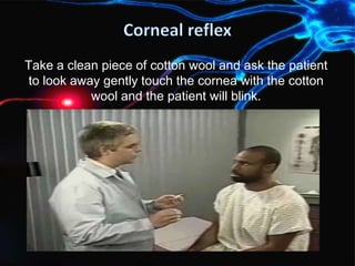 Take a clean piece of cotton wool and ask the patient
to look away gently touch the cornea with the cotton
wool and the patient will blink.
 