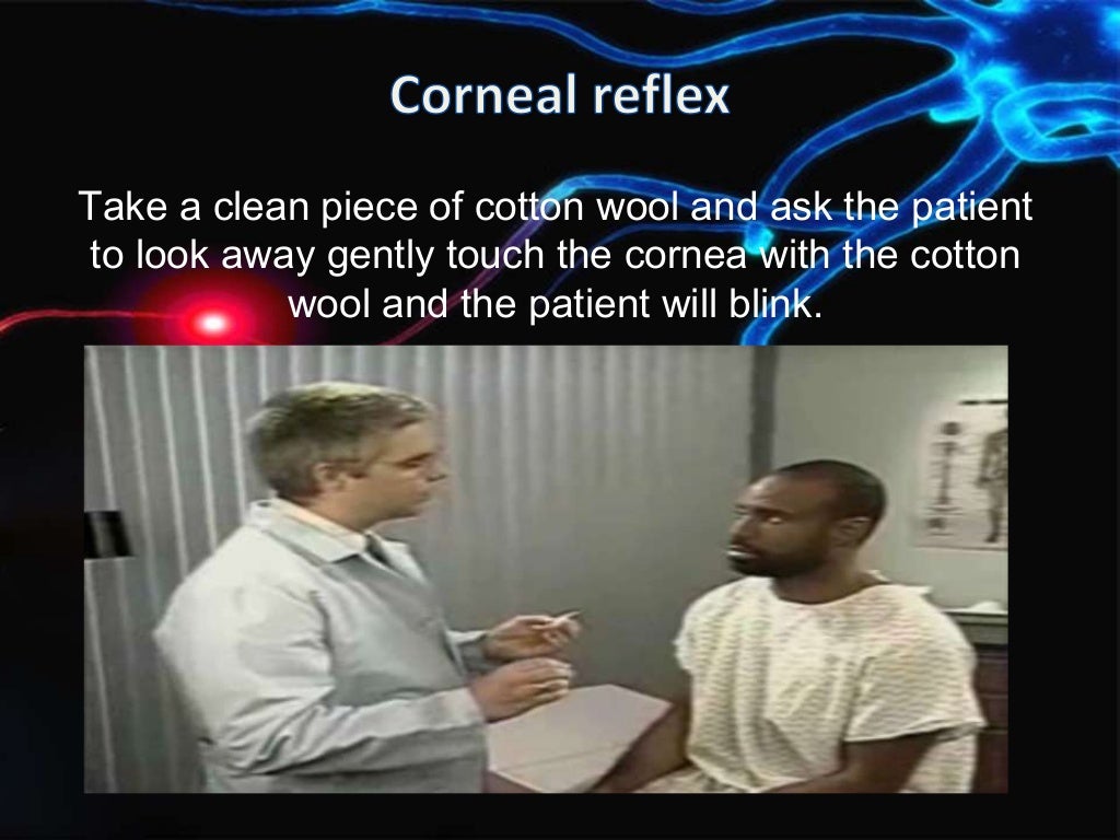 Trigeminal nerve examination