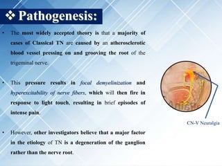 Pathogenesis:
• The most widely accepted theory is that a majority of
cases of Classical TN are caused by an atherosclerotic
blood vessel pressing on and grooving the root of the
trigeminal nerve.
• This pressure results in focal demyelinization and
hyperexcitability of nerve fibers, which will then fire in
response to light touch, resulting in brief episodes of
intense pain.
• However, other investigators believe that a major factor
in the etiology of TN is a degeneration of the ganglion
rather than the nerve root.
CN-V Neuralgia
 