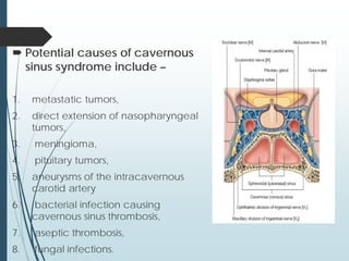  Potential causes of cavernous
sinus syndrome include –
1. metastatic tumors,
2. direct extension of nasopharyngeal
tumors,
3. meningioma,
4. pituitary tumors,
5. aneurysms of the intracavernous
carotid artery
6. bacterial infection causing
cavernous sinus thrombosis,
7. aseptic thrombosis,
8. fungal infections.
 