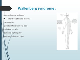 Wallenberg syndrome :
vertebral artery occlusion
 infarction of lateral medulla
symptoms –
ipsilateral facial sensory loss,
ipsilateral horners,
ipsilateral IX,X,XI palsy
contralateral sensory loss
 
