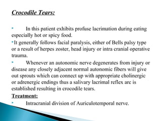 Crocodile Tears:
 In this patient exhibits profuse lacrimation during eating
especially hot or spicy food.
It generally follows facial paralysis, either of Bells palsy type
or a result of herpes zoster, head injury or intra cranial operative
trauma.
 Whenever an autonomic nerve degenerates from injury or
disease any closely adjacent normal autonomic fibers will give
out sprouts which can connect up with appropriate cholinergic
or adrenergic endings thus a salivary lacrimal reflex arc is
established resulting in crocodile tears.
Treatment:
 Intracranial division of Auriculotemporal nerve.
 