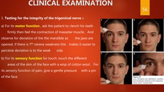 CLINICAL EXAMINATION
1. Testing for the integrity of the trigeminal nerve :-
a) For its motor function , ask the patient to clench his teeth
firmly then feel the contraction of masseter muscle. And
observe for deviation of the the mandible as the jaws are
opened. if there is 7th nereve weakness this makes it easier to
perceive deviation is to the weak side.
b) For its sensory function for touch ,touch the different
areas of the skin of the face with a wisp of cotton wool. For
its sensory function of pain, give a gentle pressure with a pin
of the face.
56
 