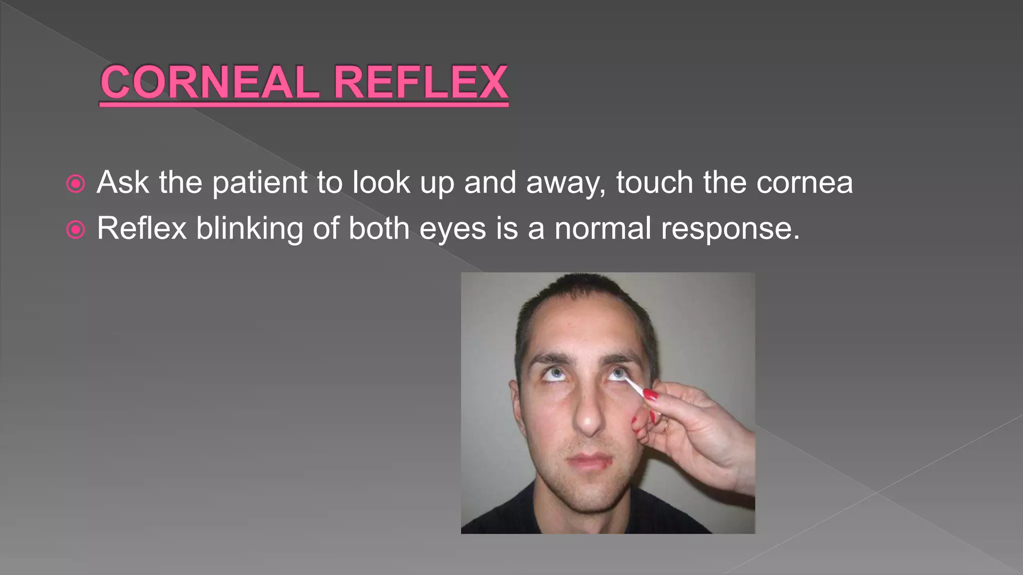  Ask the patient to look up and away, touch the cornea
 Reflex blinking of both eyes is a normal response.
 