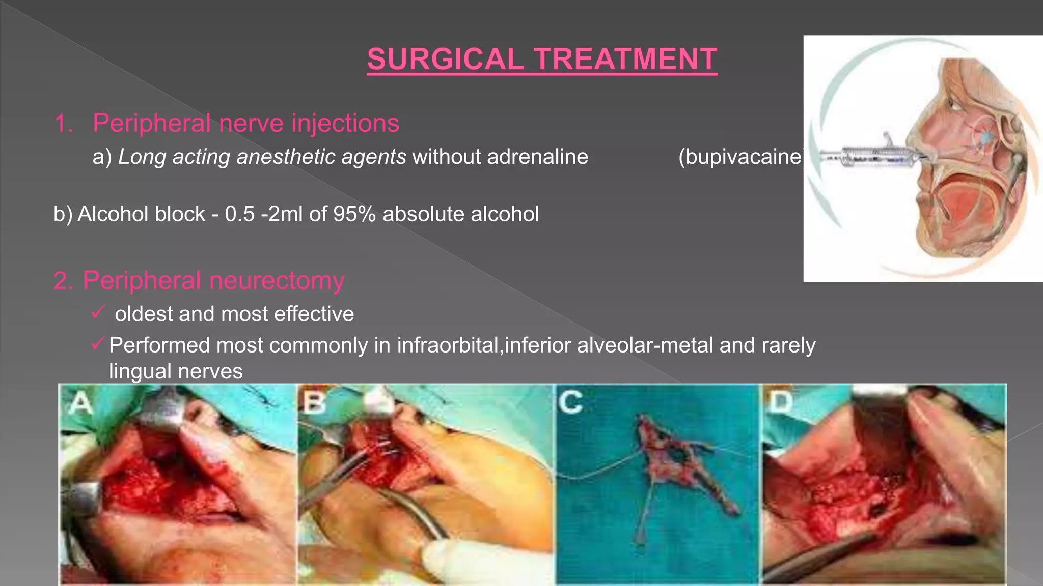 1. Peripheral nerve injections
a) Long acting anesthetic agents without adrenaline (bupivacaine)
b) Alcohol block - 0.5 -2ml of 95% absolute alcohol
2. Peripheral neurectomy
 oldest and most effective
Performed most commonly in infraorbital,inferior alveolar-metal and rarely
lingual nerves
 