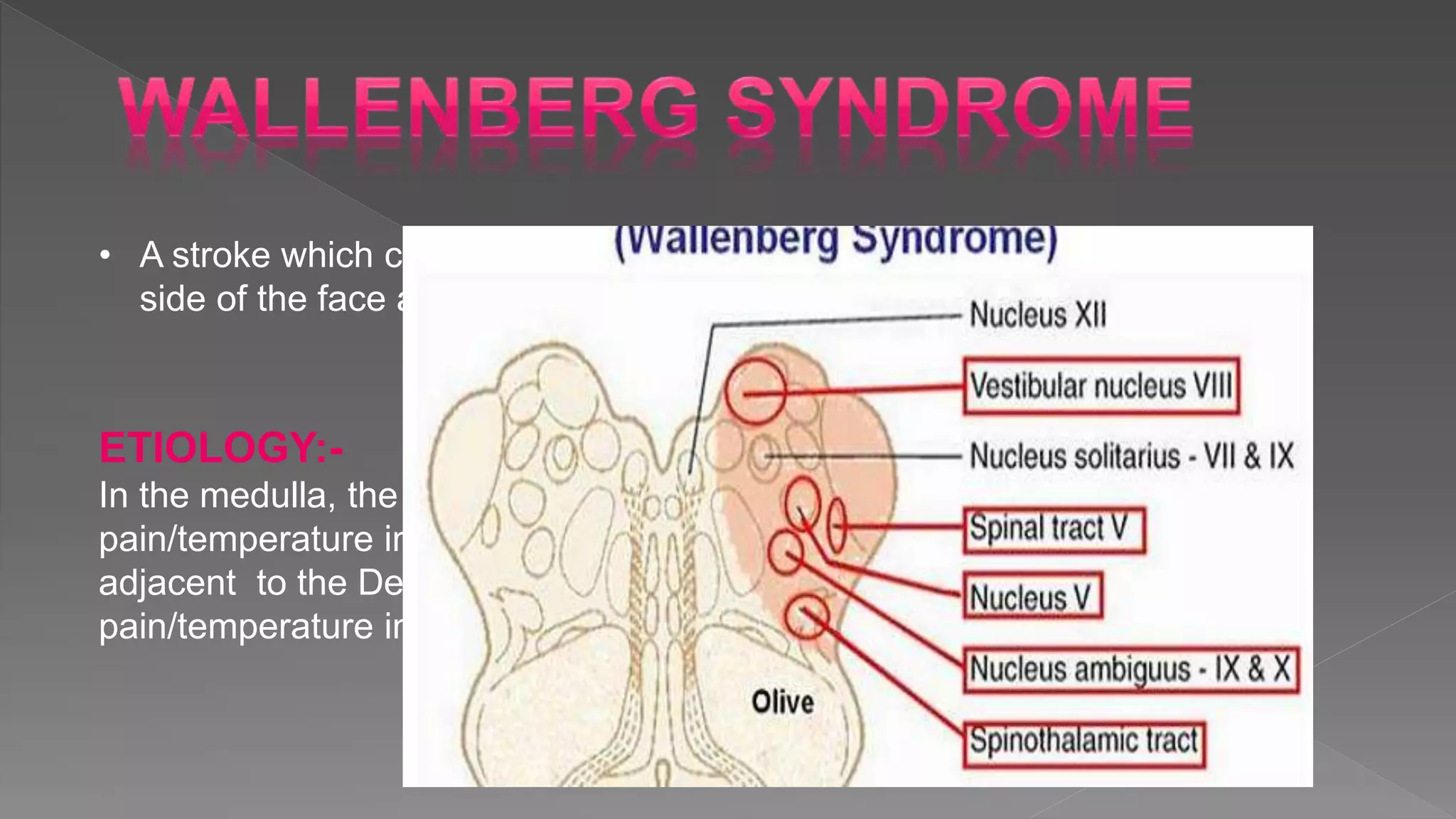 • A stroke which causes loss of pain/temperature sensation from one
side of the face and the other side of the body.
ETIOLOGY:-
In the medulla, the Ascending Spinothalamic Tract (which carries
pain/temperature information from the opposite side of the body) is
adjacent to the Descending Spinal Tract of the fifth nerve (which carries
pain/temperature information from the same side of the face)
 