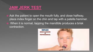  Ask the patient to open the mouth fully, and close halfway,
place index finger on the chin and tap with a patella hammer.
 When it is normal, tapping the mandible produces a brisk
contraction.
 