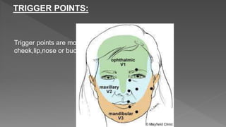 TRIGGER POINTS:
Trigger points are most commonly located on the
cheek,lip,nose or buccal mucosa.
 