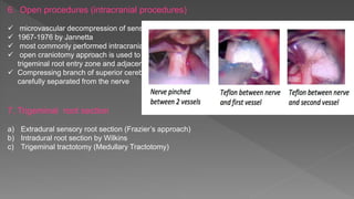 6. Open procedures (intracranial procedures)
 microvascular decompression of sensory root
 1967-1976 by Jannetta
 most commonly performed intracranial open procedure
 open craniotomy approach is used to gain access to the
trigeminal root entry zone and adjacent brain stem
 Compressing branch of superior cerebellar artery is
carefully separated from the nerve
7. Trigeminal root section
a) Extradural sensory root section (Frazier’s approach)
b) Intradural root section by Wilkins
c) Trigeminal tractotomy (Medullary Tractotomy)
 