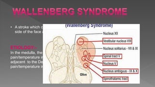 • A stroke which causes loss of pain/temperature sensation from one
side of the face and the other side of the body.
ETIOLOGY:-
In the medulla, the Ascending Spinothalamic Tract (which carries
pain/temperature information from the opposite side of the body) is
adjacent to the Descending Spinal Tract of the fifth nerve (which carries
pain/temperature information from the same side of the face)
 