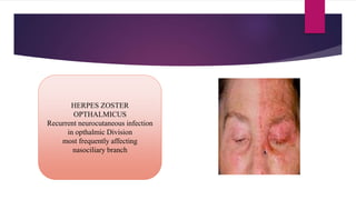 Trigeminal nerve PPTX