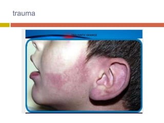 trauma
 