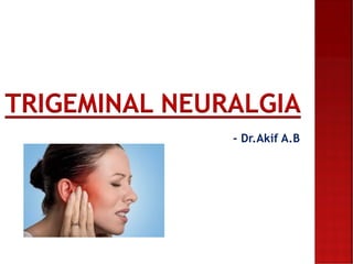 TRIGEMINAL NEURALGIA
- Dr.Akif A.B
 