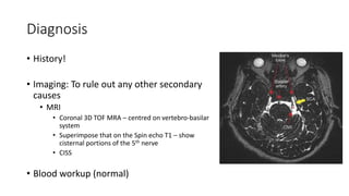 Diagnosis
• History!
• Imaging: To rule out any other secondary
causes
• MRI
• Coronal 3D TOF MRA – centred on vertebro-basilar
system
• Superimpose that on the Spin echo T1 – show
cisternal portions of the 5th nerve
• CISS
• Blood workup (normal)
 
