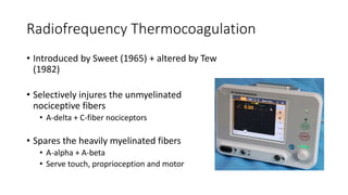 Radiofrequency Thermocoagulation
• Introduced by Sweet (1965) + altered by Tew
(1982)
• Selectively injures the unmyelinated
nociceptive fibers
• A-delta + C-fiber nociceptors
• Spares the heavily myelinated fibers
• A-alpha + A-beta
• Serve touch, proprioception and motor
 