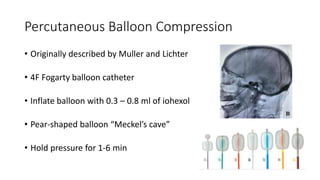 Percutaneous Balloon Compression
• Originally described by Muller and Lichter
• 4F Fogarty balloon catheter
• Inflate balloon with 0.3 – 0.8 ml of iohexol
• Pear-shaped balloon “Meckel’s cave”
• Hold pressure for 1-6 min
 