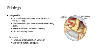 Etiology
• Idiopathic
• Usually from pulsations of an aberrant
vascular loop
• Most commonly: Superior cerebellar artery
(80%)
• Anterior inferior cerebellar artery
• Less commonly: Vein
• Secondary
• Tumours near Gasserion Ganglion
• Multiple Sclerosis (plaques)
 