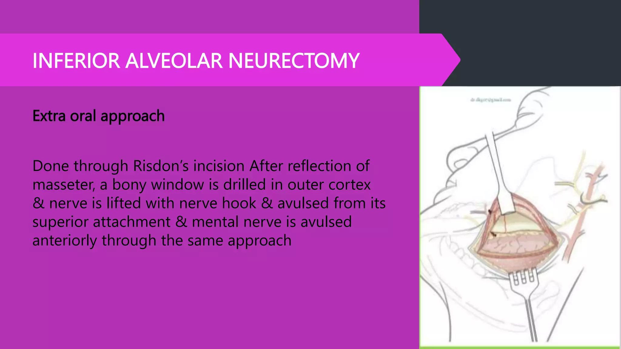 INFERIOR ALVEOLAR NEURECTOMY
Extra oral approach
Done through Risdon’s incision After reflection of
masseter, a bony window is drilled in outer cortex
& nerve is lifted with nerve hook & avulsed from its
superior attachment & mental nerve is avulsed
anteriorly through the same approach
 