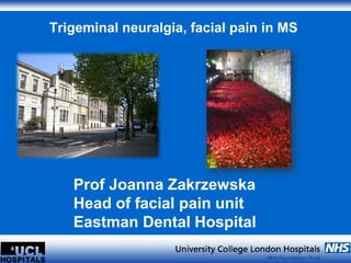 Trigeminal neuralgia, facial pain in MS 
Prof Joanna Zakrzewska 
Head of facial pain unit 
Eastman Dental Hospital 
 