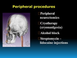 Trigeminalneuralgiaseminar2 180526065218-converted | PPTX