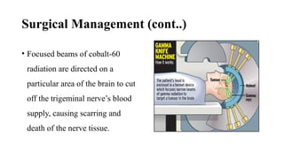 Surgical Management (cont..)
• Focused beams of cobalt-60
radiation are directed on a
particular area of the brain to cut
off the trigeminal nerve’s blood
supply, causing scarring and
death of the nerve tissue.
 