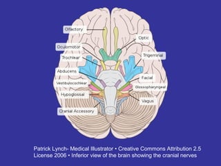Patrick Lynch- Medical Illustrator • Creative Commons Attribution 2.5
License 2006 • Inferior view of the brain showing the cranial nerves
 