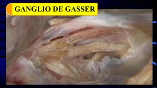 GANGLIO DE GASSER
 