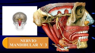 NERVIO
MANDIBULAR V 3
 