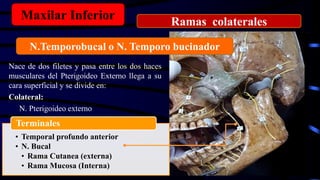 Nace de dos filetes y pasa entre los dos haces
musculares del Pterigoideo Externo llega a su
cara superficial y se divide en:
Colateral:
N. Pterigoideo externo
Maxilar Inferior
N.Temporobucal o N. Temporo bucinador
Ramas colaterales
• Temporal profundo anterior
• N. Bucal
• Rama Cutanea (externa)
• Rama Mucosa (Interna)
Terminales
 