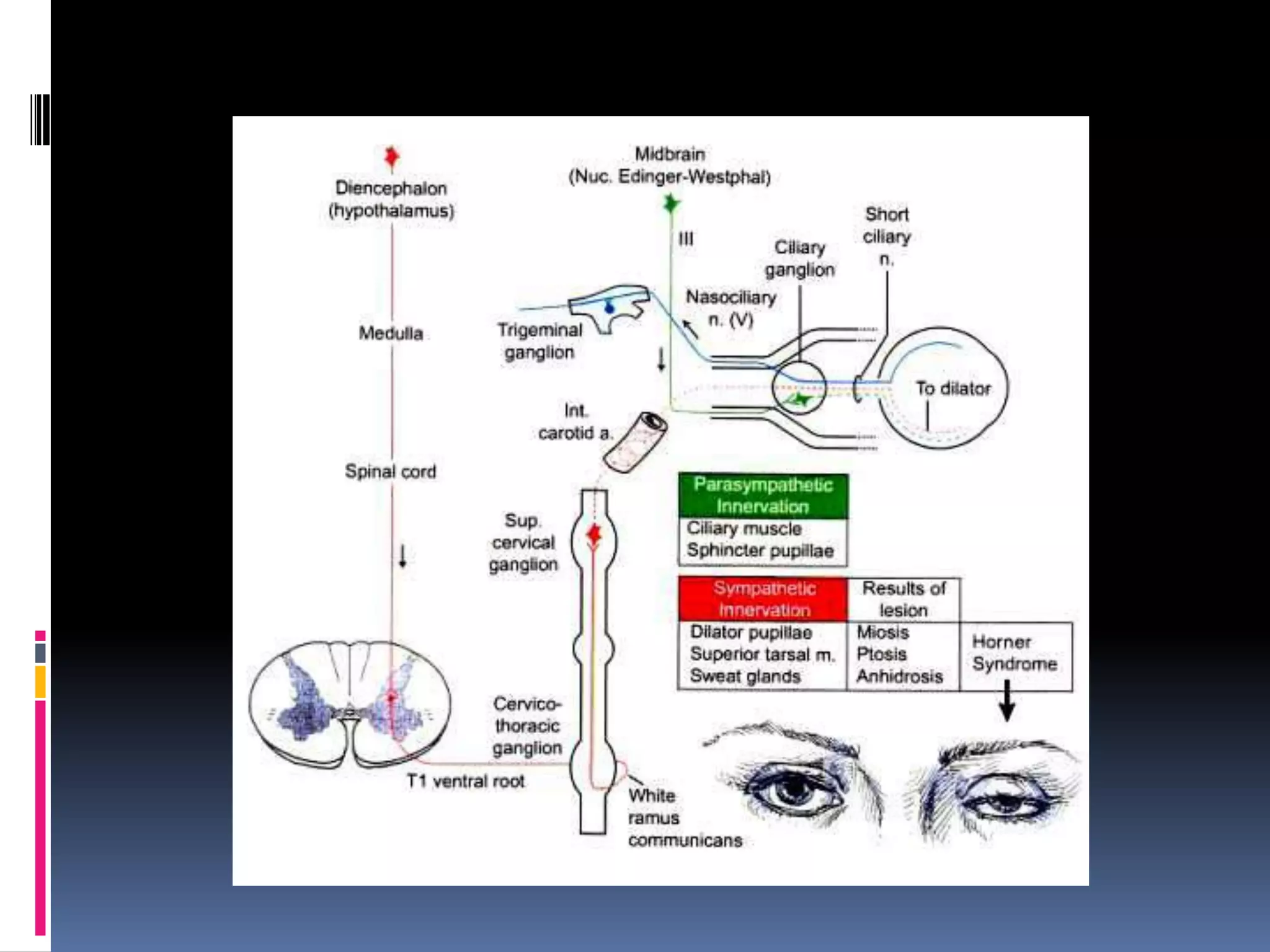 Case: Hemisection of The Spinal Cord