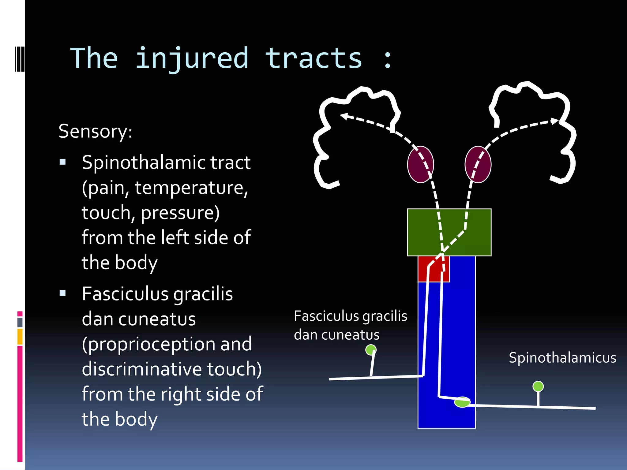 Case: Hemisection of The Spinal Cord