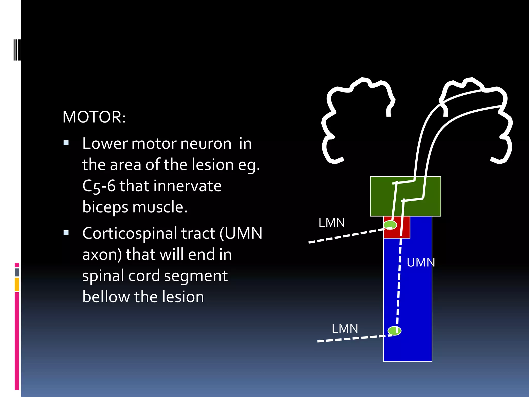 Case: Hemisection of The Spinal Cord