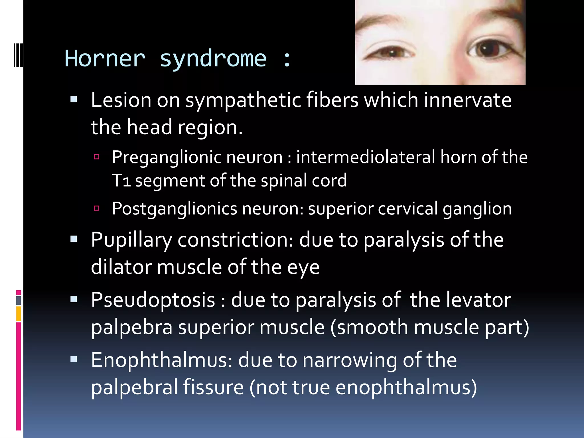 Case: Hemisection of The Spinal Cord