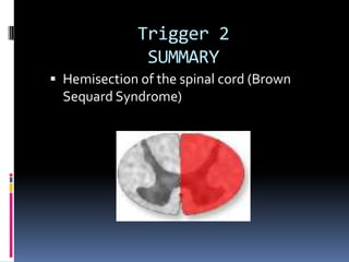 Trigger 2
               SUMMARY
 Hemisection of the spinal cord (Brown
  Sequard Syndrome)
 