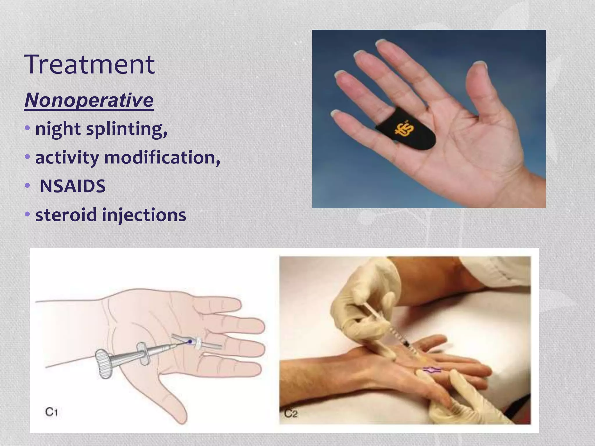 Treatment
Nonoperative
• night splinting,
• activity modification,
• NSAIDS
• steroid injections
 