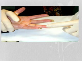 Clinical presentation
Physical examination
• tenderness to palpation over A1 pulley
• tender nodule
• asked the patient to fully open and close the hand  locking
or clicking
• Pain may be aggravated by stretching the tendon in
extension
 