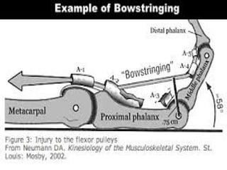 trigger finger causes, symptoms and treatment