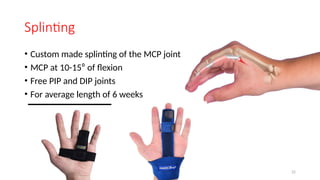Pip Trigger trigger finger online CME trigger finger online CME | PPTX