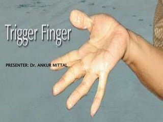 Trigger finger - Overview - Mayo Clinic Orthopedics & Sports Medicine