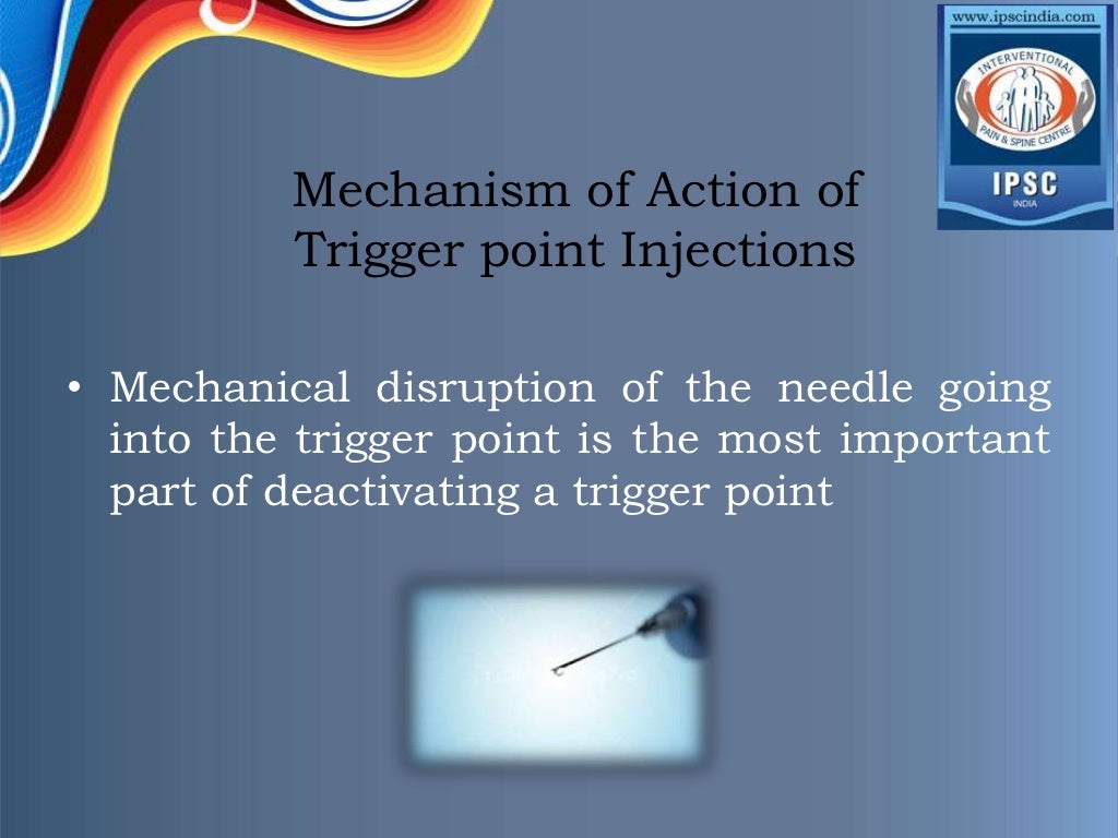 Trigger point injection